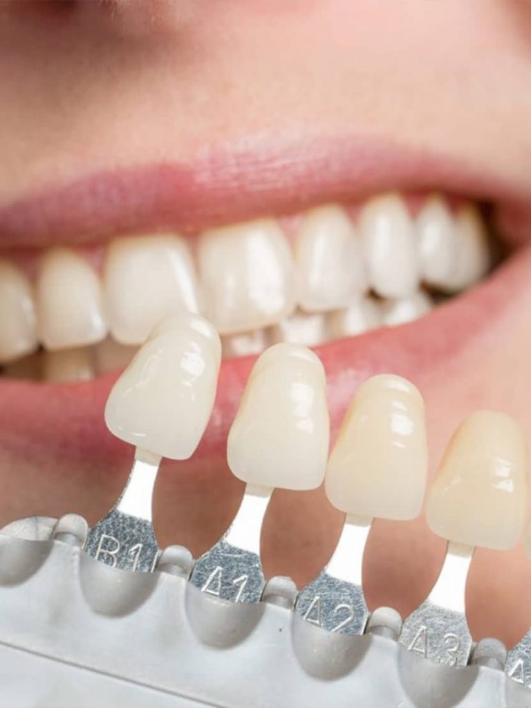 Estetica denti Studio Dentistico Del Ben - Trieste
